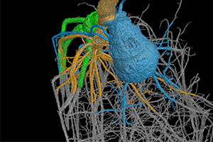 Root architecture discoveries could help breed drought-resistant crops